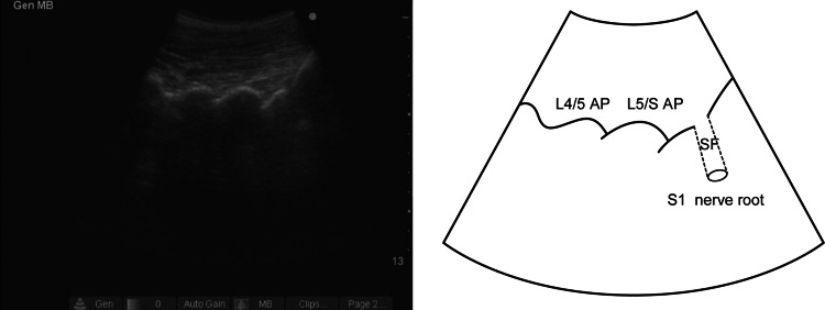 Fig. 1