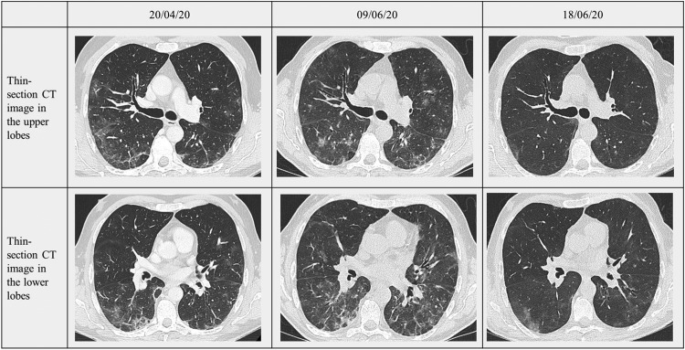 Fig. 1