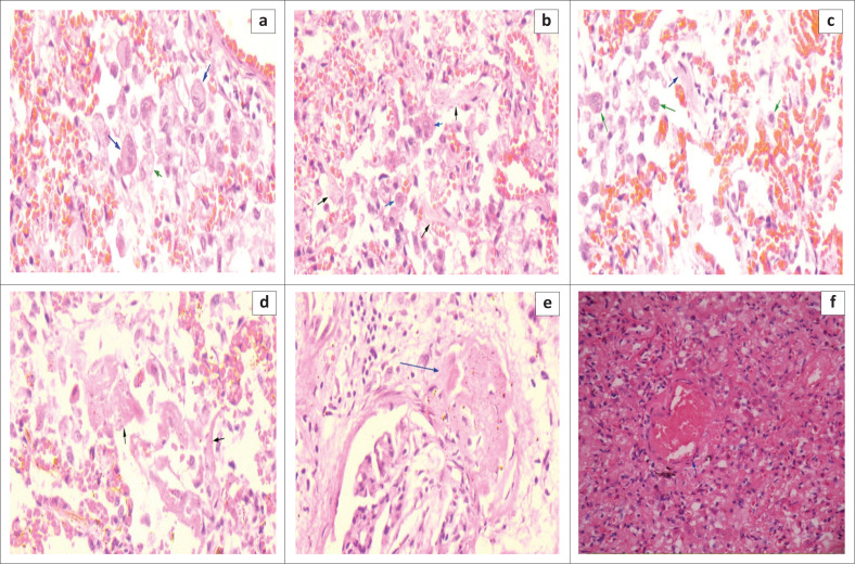 FIGURE 3