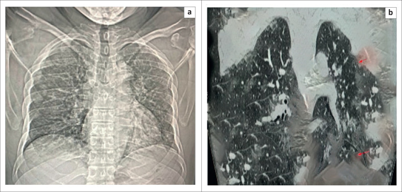 FIGURE 4