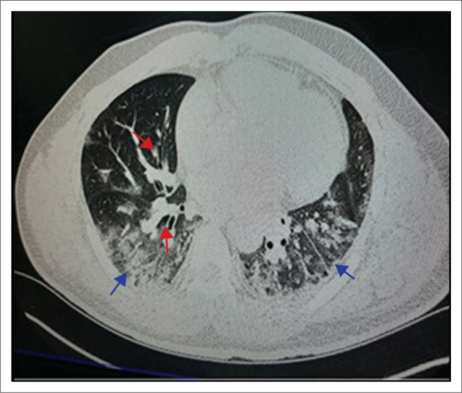 FIGURE 2