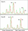 Fig. 1