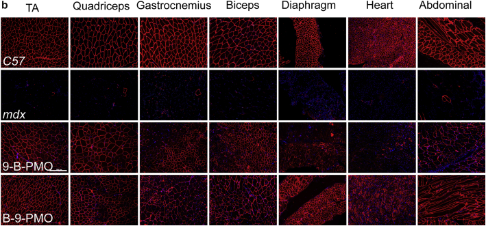 Figure 1b