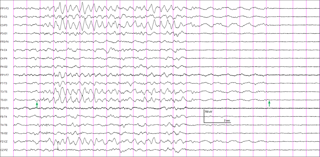 Figure 1 –