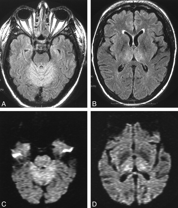 fig 3.