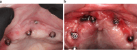 Fig. 13