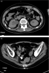 Fig. 1
