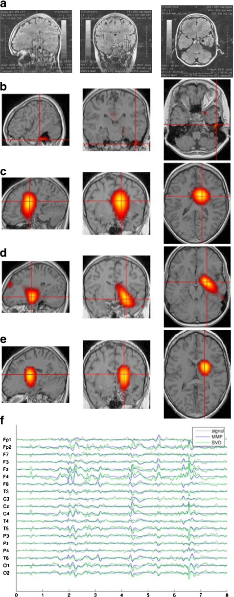 Fig. 3