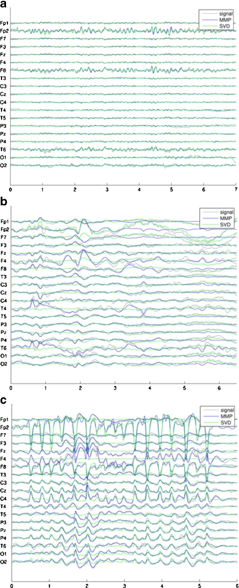 Fig. 2