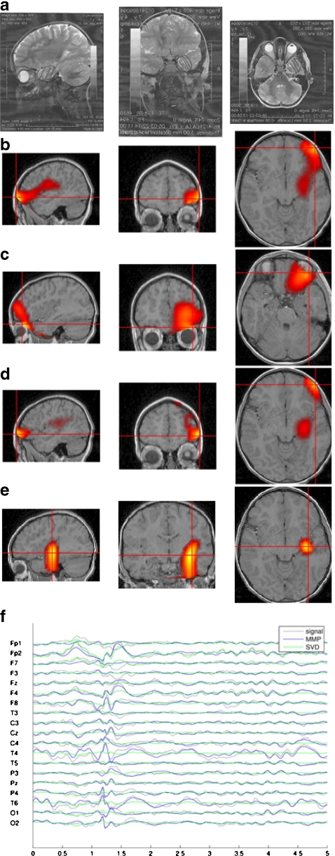 Fig. 4