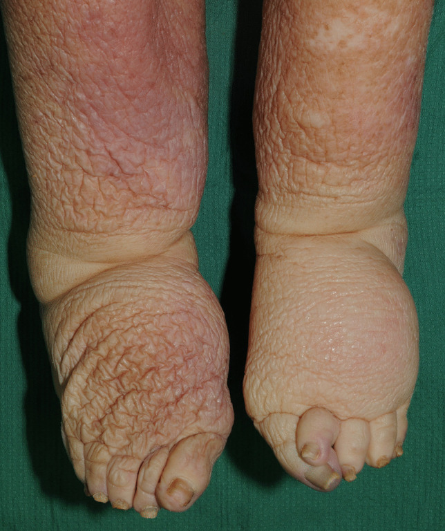 Fig. 5