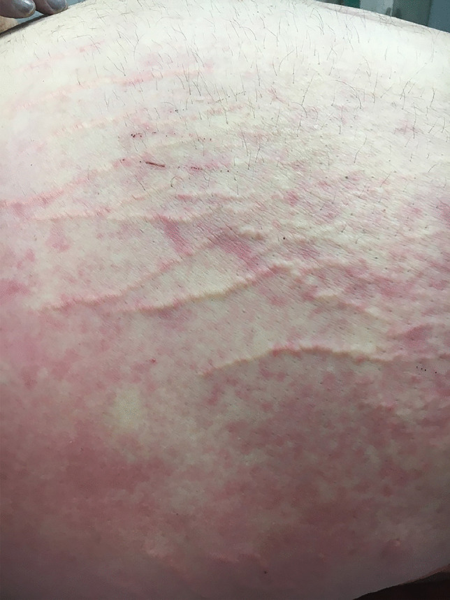Fig. 4