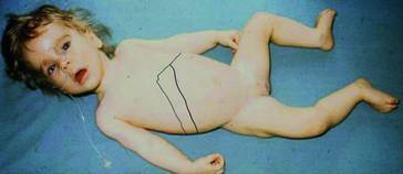 graphic file with name 978-3-642-24710-1_17_Fig8_HTML.jpg