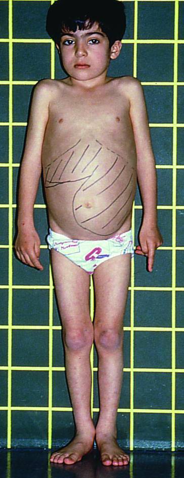 graphic file with name 978-3-642-24710-1_17_Fig9_HTML.jpg