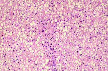 graphic file with name 978-3-642-24710-1_17_Fig17_HTML.jpg