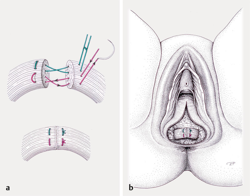 Fig. 3