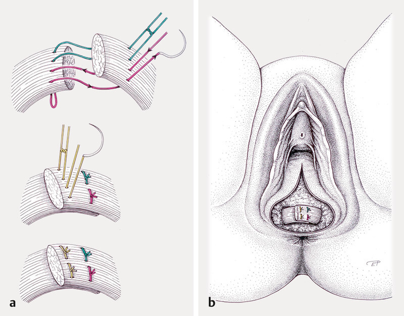 Fig. 2