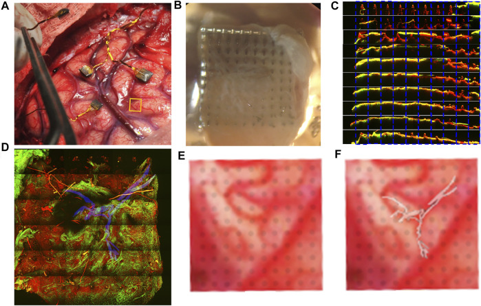 FIGURE 4