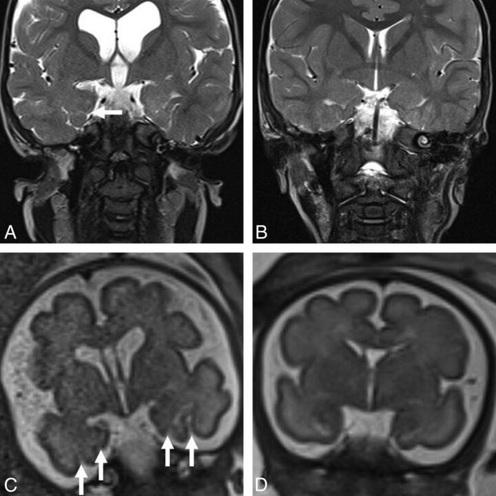 Fig 4.