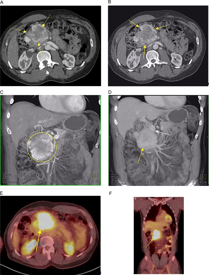 Fig 1 A