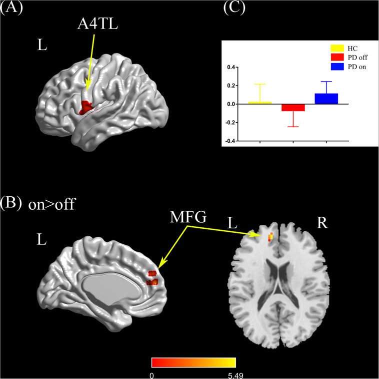 FIGURE 4