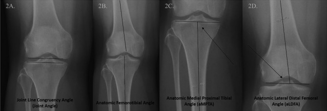 Figure 2. A,.