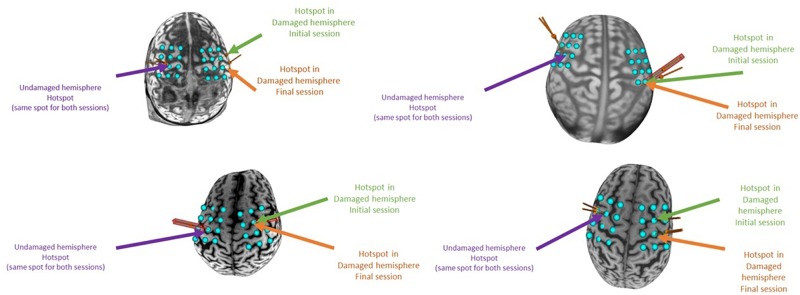 FIGURE 11