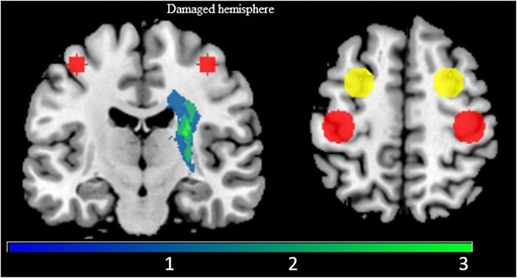 FIGURE 3