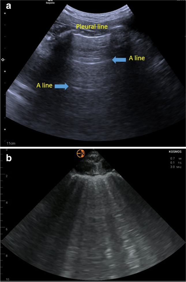 Fig. 13