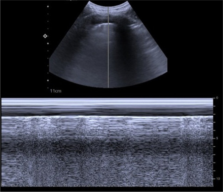 Fig. 14