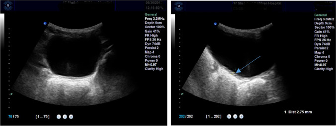 Fig. 12