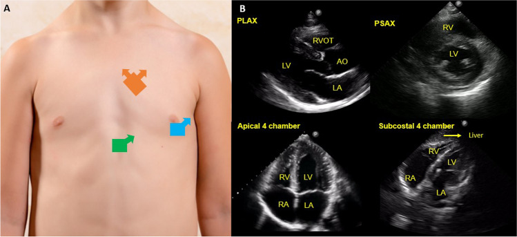 Fig. 16