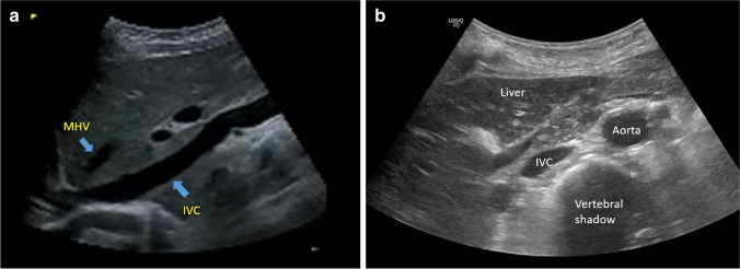 Fig. 17