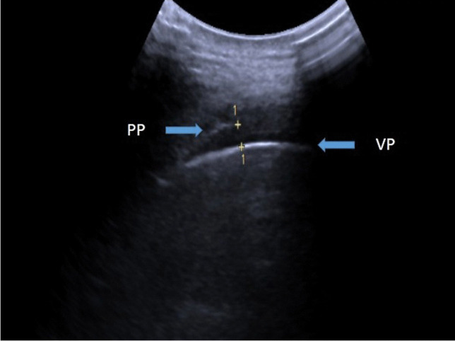 Fig. 15