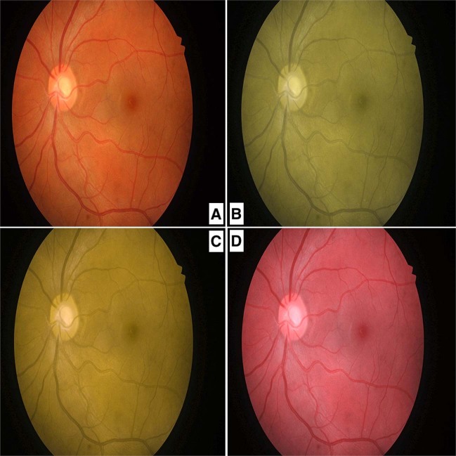 Fig. 1