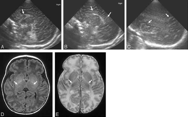 Fig 4.