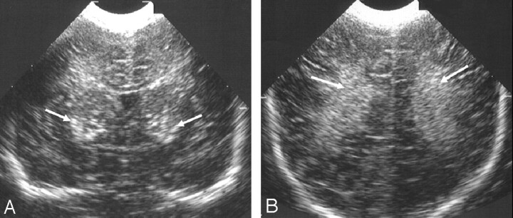 Fig 1.