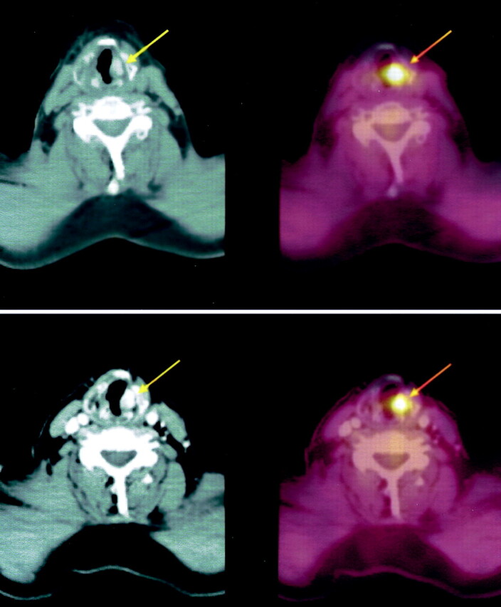 Fig 2.