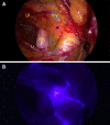 Fig. 2