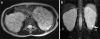 Fig. 11
