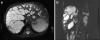 Fig. 19