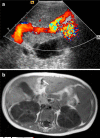 Fig. 16