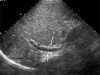 Fig. 13