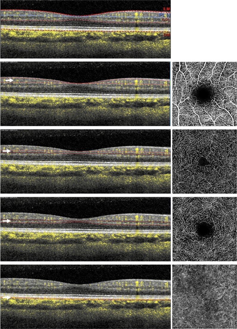 Fig. 1