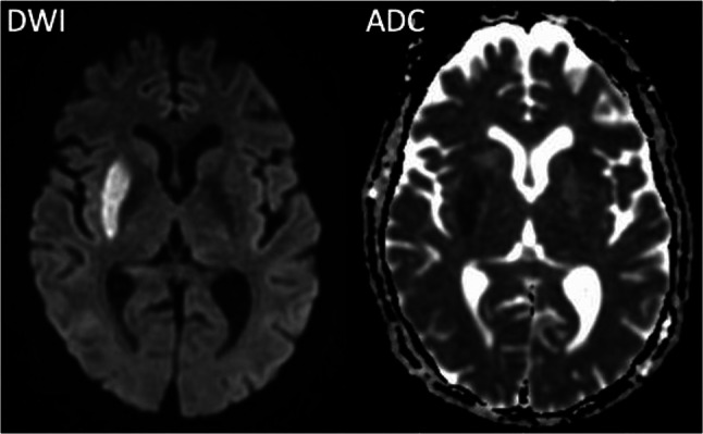 Fig. 4