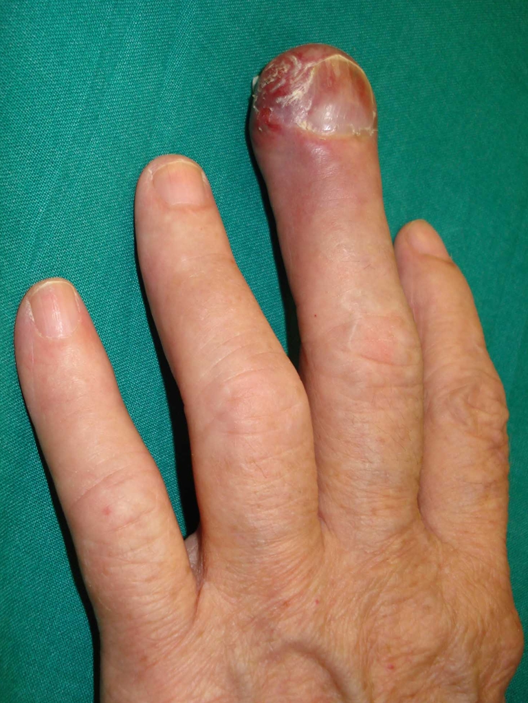 Fig. 1