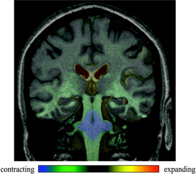 Fig. 3