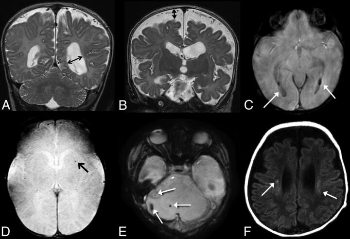 Fig 2.