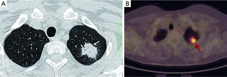 Figure 13
