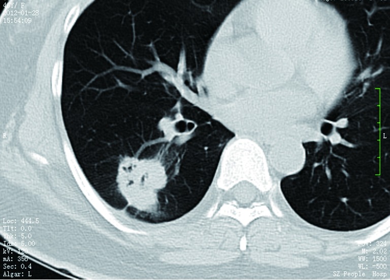 Figure 5
